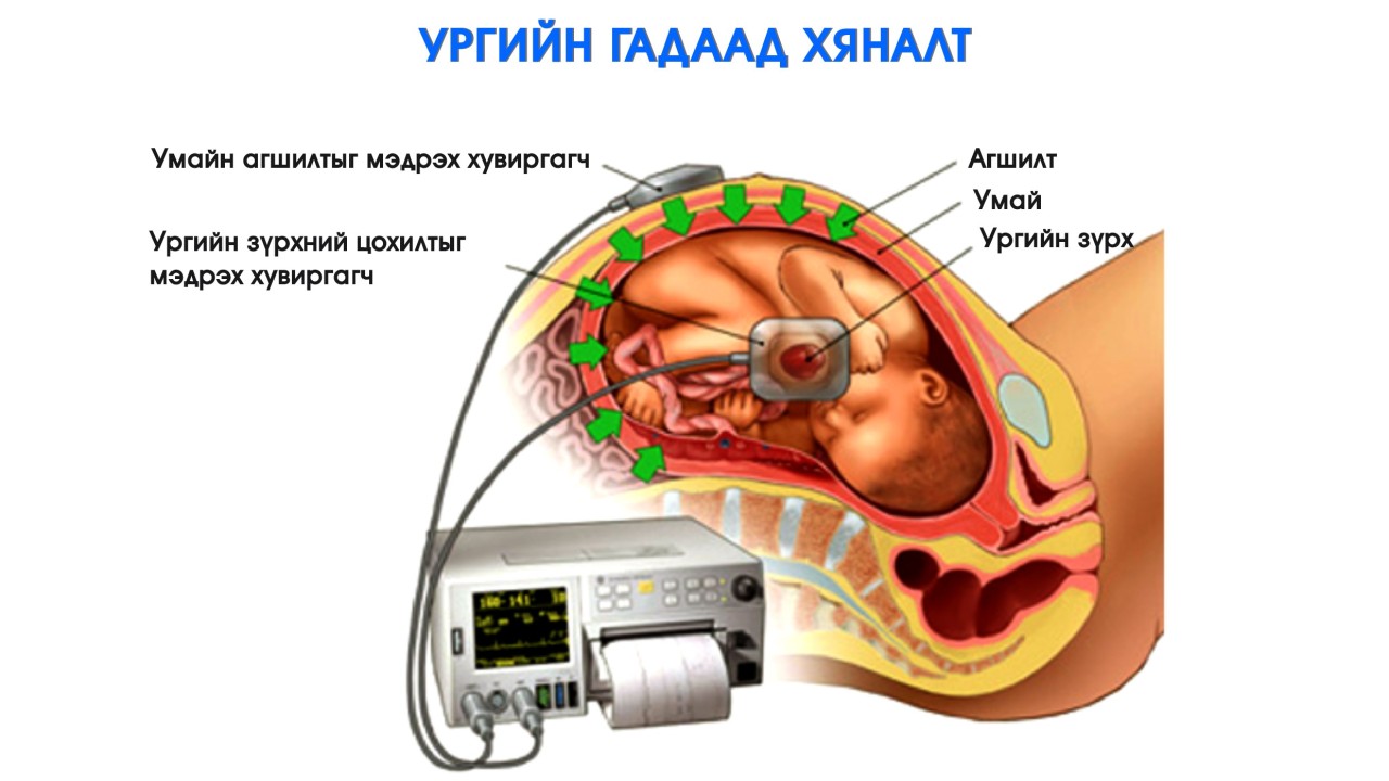 Ургийн бичлэг гэж юу вэ?