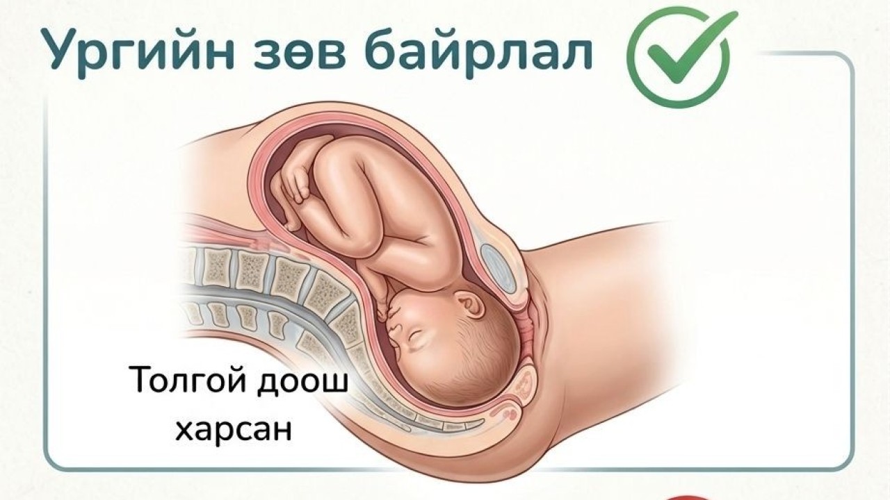 Жирэмсний сүүл үед